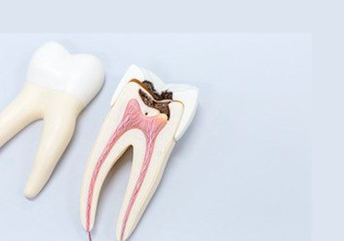 Endodoncia Lux Dental