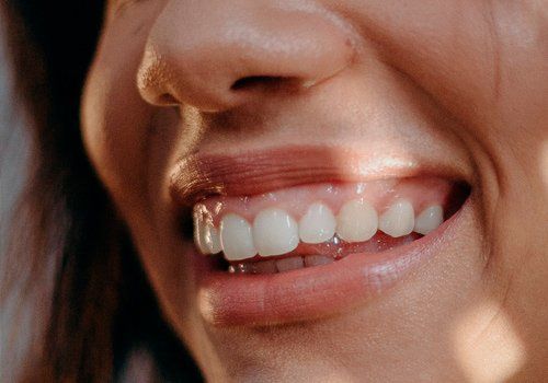 Tratamiento de encías