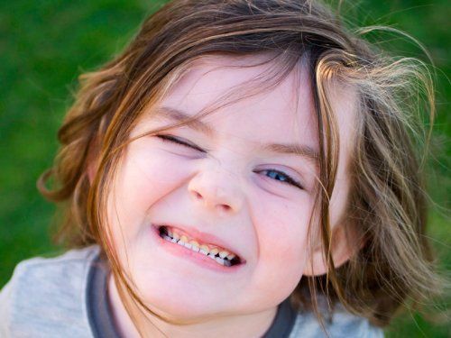 Odontopedriatía en Gijón