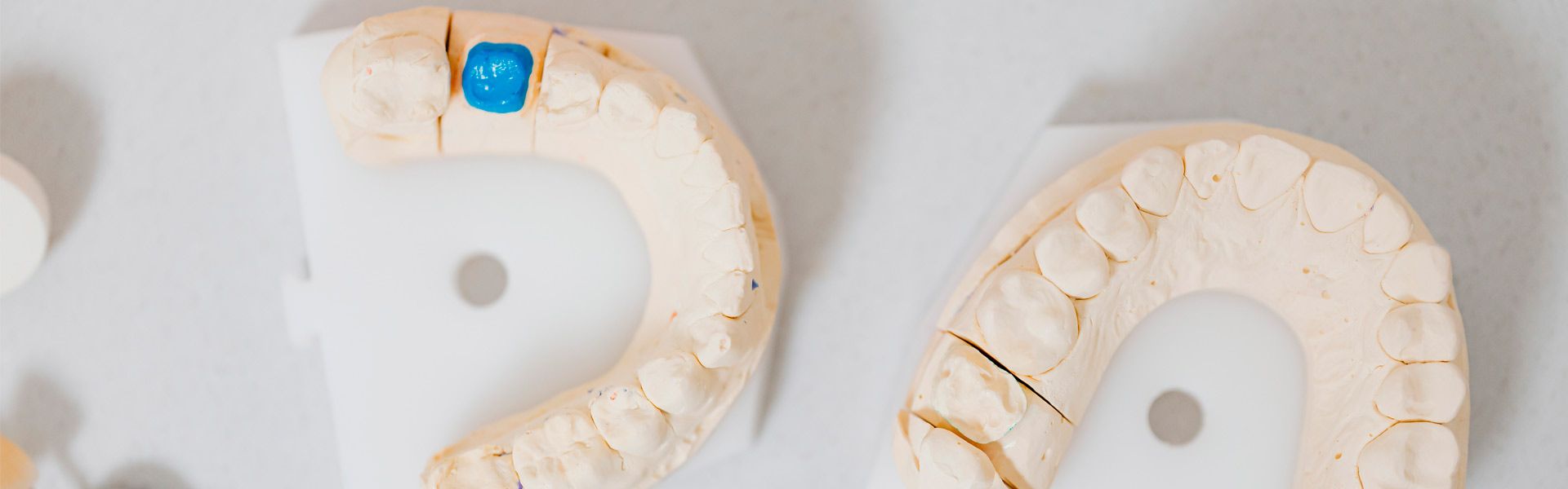 Tratamientos dentales en Gijón