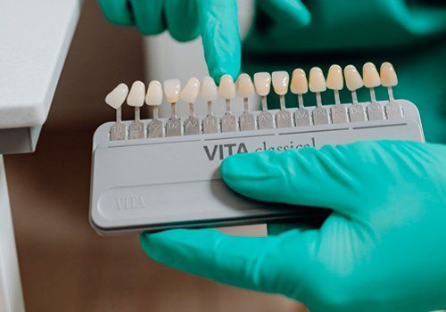 Blanqueamiento Dental