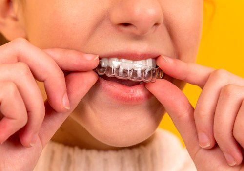 Ortopedia dentalofacial en Gijón